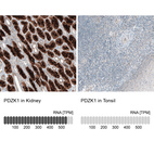 Anti-PDZK1 Antibody