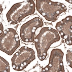 Immunohistochemical staining of human small intestine shows moderate to strong positivity in luminal membrane in glandular cells.