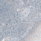 Immunohistochemical staining of human tonsil shows no positivity as expected.
