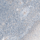 Anti-PDZK1 Antibody