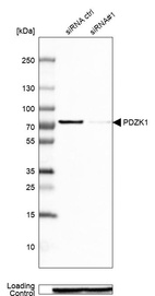 Anti-PDZK1 Antibody