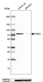 Western blot analysis in Caco-2 cells transfected with control siRNA, target specific siRNA probe #1, using Anti-PDZK1 antibody. Remaining relative intensity is presented. Loading control: Anti-GAPDH.