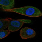 Immunofluorescent staining of human cell line RPTEC TERT1 shows localization to nucleus, cytosol & vesicles.