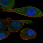 Immunofluorescent staining of human cell line RPTEC TERT1 shows localization to nucleus, cytosol & vesicles.