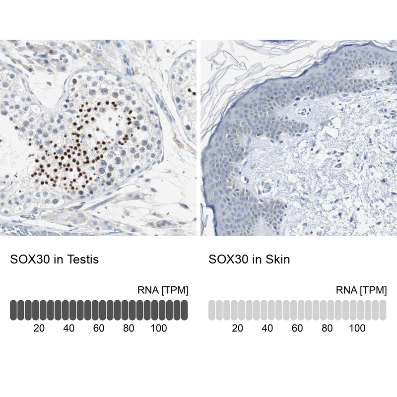 Anti-SOX30 Antibody