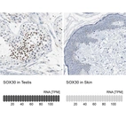 Anti-SOX30 Antibody
