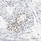 Immunohistochemical staining of human Testis shows strong nuclear positivity in spermatids.