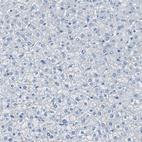 Immunohistochemical staining of human Liver shows no positivity in hepatocytes as expected.