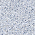 Immunohistochemical staining of human Liver shows no positivity in hepatocytes as expected.