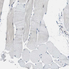 Anti-SOX30 Antibody