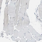 Immunohistochemical staining of human Skeletal muscle shows no positivity in myocytes as expected.