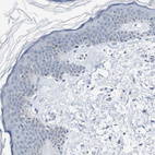 Anti-SOX30 Antibody