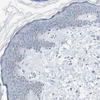 Immunohistochemical staining of human Skin shows no positivity in squamous epithelial cells as expected.