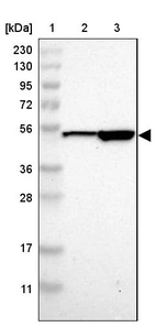 Lane 1: Marker [kDa] 230, 130, 95, 72, 56, 36, 28, 17, 11_br/_Lane 2: Human cell line RT-4_br/_Lane 3: Human cell line U-251MG sp