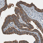 Anti-TSG101 Antibody