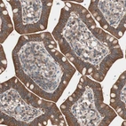 Immunohistochemical staining of human small intestine shows strong cytoplasmic positivity in glandular cells.