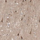 Immunohistochemical staining of human cerebral cortex shows moderate cytoplasmic positivity in neurons.