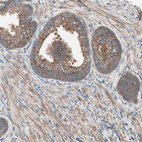 Anti-TSG101 Antibody