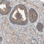 Immunohistochemical staining of human prostate shows moderate cytoplasmic positivity in glandular and in smooth muscle cells.