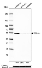 Western blot analysis in MCF-7 cells transfected with control siRNA, target specific siRNA probe #1 and #2, using Anti-TSG101 antibody. Remaining relative intensity is presented. Loading control: Anti-GAPDH.