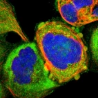 Immunofluorescent staining of human cell line A-431 shows localization to plasma membrane & cytosol.
