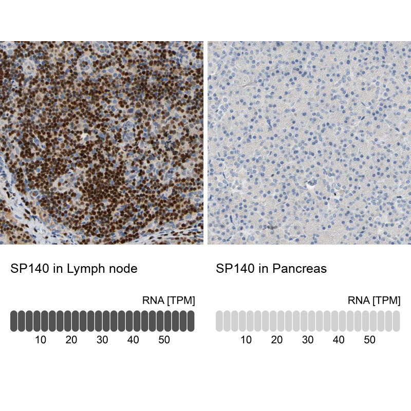 Anti-SP140 Antibody
