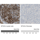 Anti-SP140 Antibody