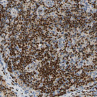 Anti-SP140 Antibody