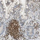Immunohistochemical staining of human small intestine shows strong nuclear positivity in lymphoid cells.