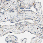 Anti-SP140 Antibody