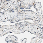 Immunohistochemical staining of human placenta shows strong nuclear positivity in lymphoid cells.