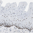 Anti-AJUBA Antibody