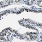 Immunohistochemical staining of human Fallopian tube shows strong nuclear positivity in glandular cells.