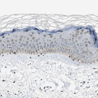 Immunohistochemical staining of human skin shows moderate nuclear positivity in squamous epithelial cells.