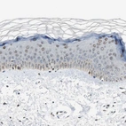Immunohistochemical staining of human skin shows moderate nuclear positivity in squamous epithelial cells.
