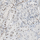 Immunohistochemical staining of human kidney shows moderate nuclear positivity in cells in tubules.