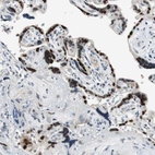 Immunohistochemical staining of human placenta shows strong nuclear positivity in trophoblastic cells.