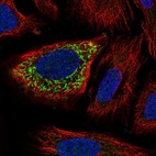 Immunofluorescent staining of human cell line SiHa shows localization to mitochondria.