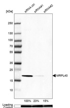 Western blot analysis in HEK293 cells transfected with control siRNA, target specific siRNA probe #1 and #2, using Anti-MRPL40 antibody. Remaining relative intensity is presented. Loading control: Anti-GAPDH.