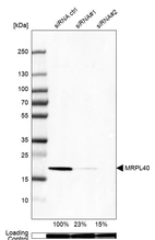 Western blot analysis in HEK293 cells transfected with control siRNA, target specific siRNA probe #1 and #2, using Anti-MRPL40 antibody. Remaining relative intensity is presented. Loading control: Anti-GAPDH.
