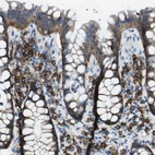 Immunohistochemical staining of human colon shows moderate to strong membranous positivity in lymphoid cells as well as in glandular cells.