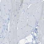 Immunohistochemical staining of human skeletal muscle shows no positivity in striated muscle fibers as expected.