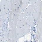 Immunohistochemical staining of human skeletal muscle shows no positivity in striated muscle fibers as expected.