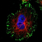 Immunofluorescent staining of human cell line U-251 MG shows localization to focal adhesion sites.