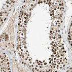 Anti-TAF5 Antibody