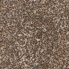 Immunohistochemical staining of human lymph node shows strong nuclear positivity in non-germinal center cells.