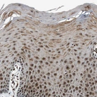 Immunohistochemical staining of human cervix shows strong nuclear positivity in squamous epithelial cells.