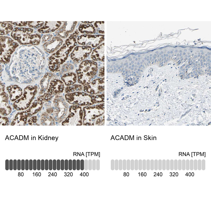 Anti-ACADM Antibody