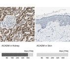Anti-ACADM Antibody