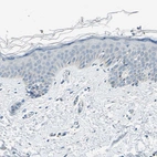 Immunohistochemical staining of human skin shows no positivity in squamous epithelial cells as expected.